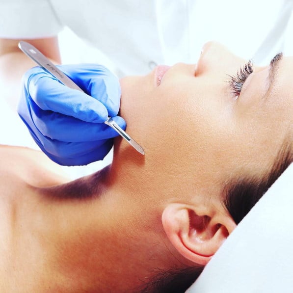 Dermaplaning in Boca Raton