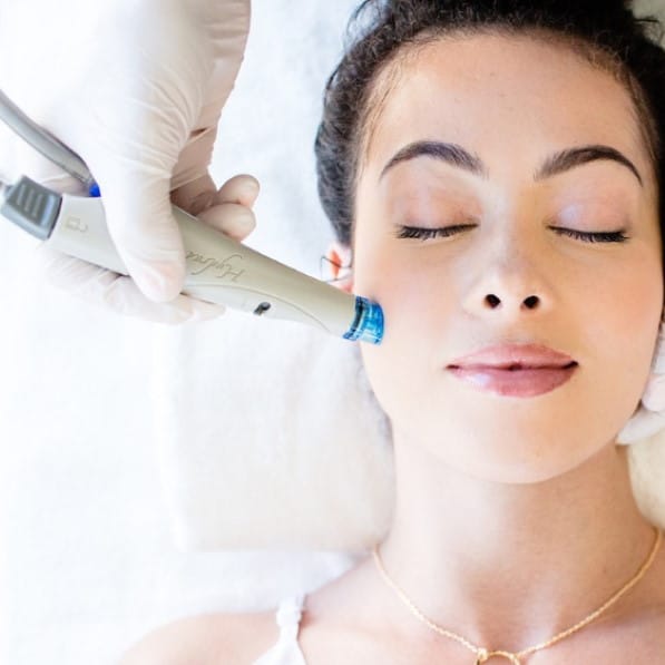 Hydrafacial in Boca Raton