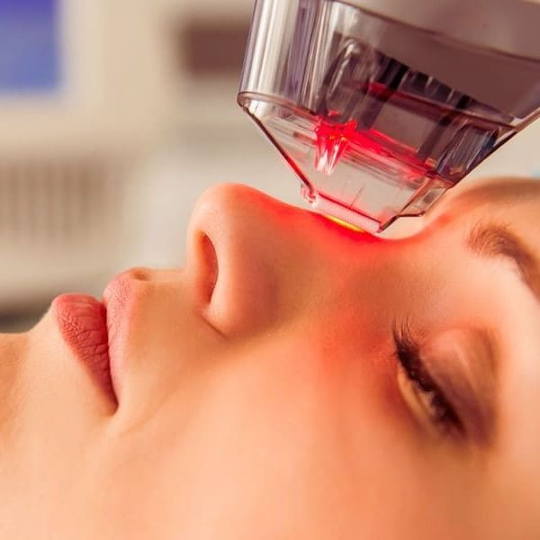 laser skin resurfacing