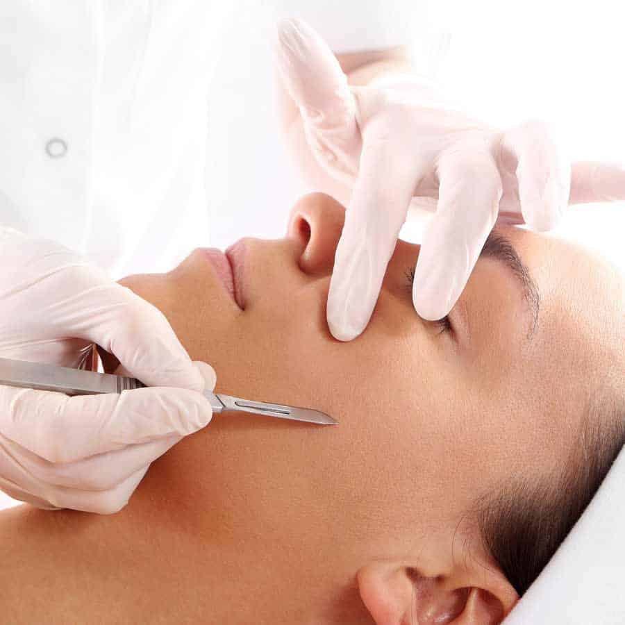 Dermaplaning Treatments in Boca Raton