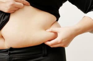 Stubborn Body Fat Reduction in Boca Raton